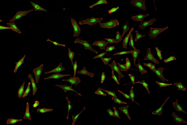 Analyse au microscope