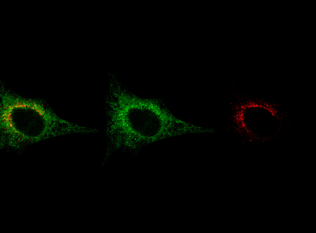 Homeostasis and Modulation of ERES (HoMER)