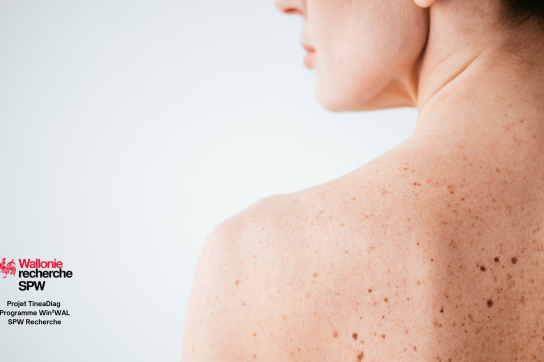 Femme de dos, la peau nue